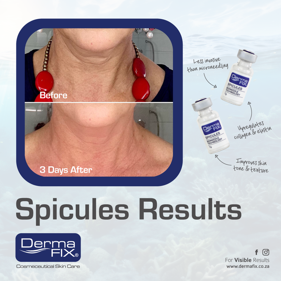 Dermafix Spicules Training -COST OF CLASS INCLUDES 4 VILES OF SPICULES (12 TREATMENTS)