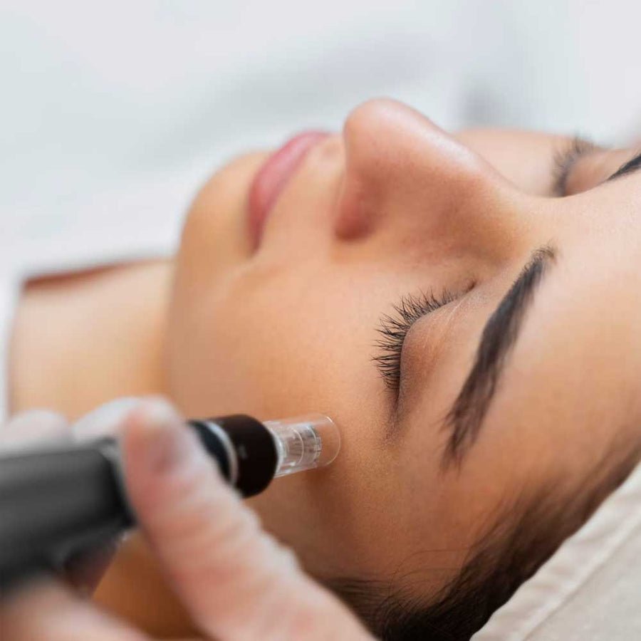 Skin Needling Training